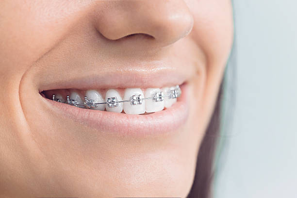 Why Choose Us for Your Dental Needs in Gardnerville, NV